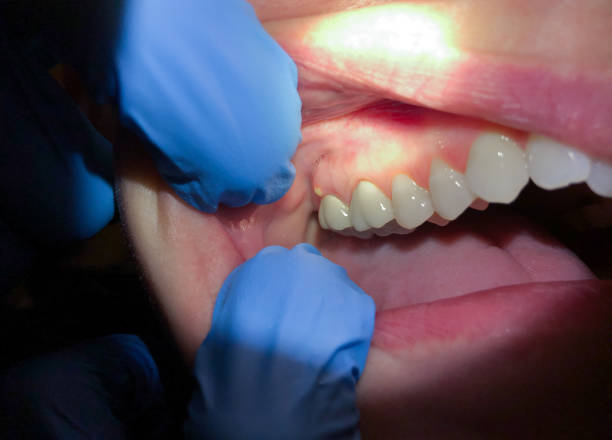 Best Broken or Cracked Tooth Emergency Dentist in Gloucester Courthouse, VA